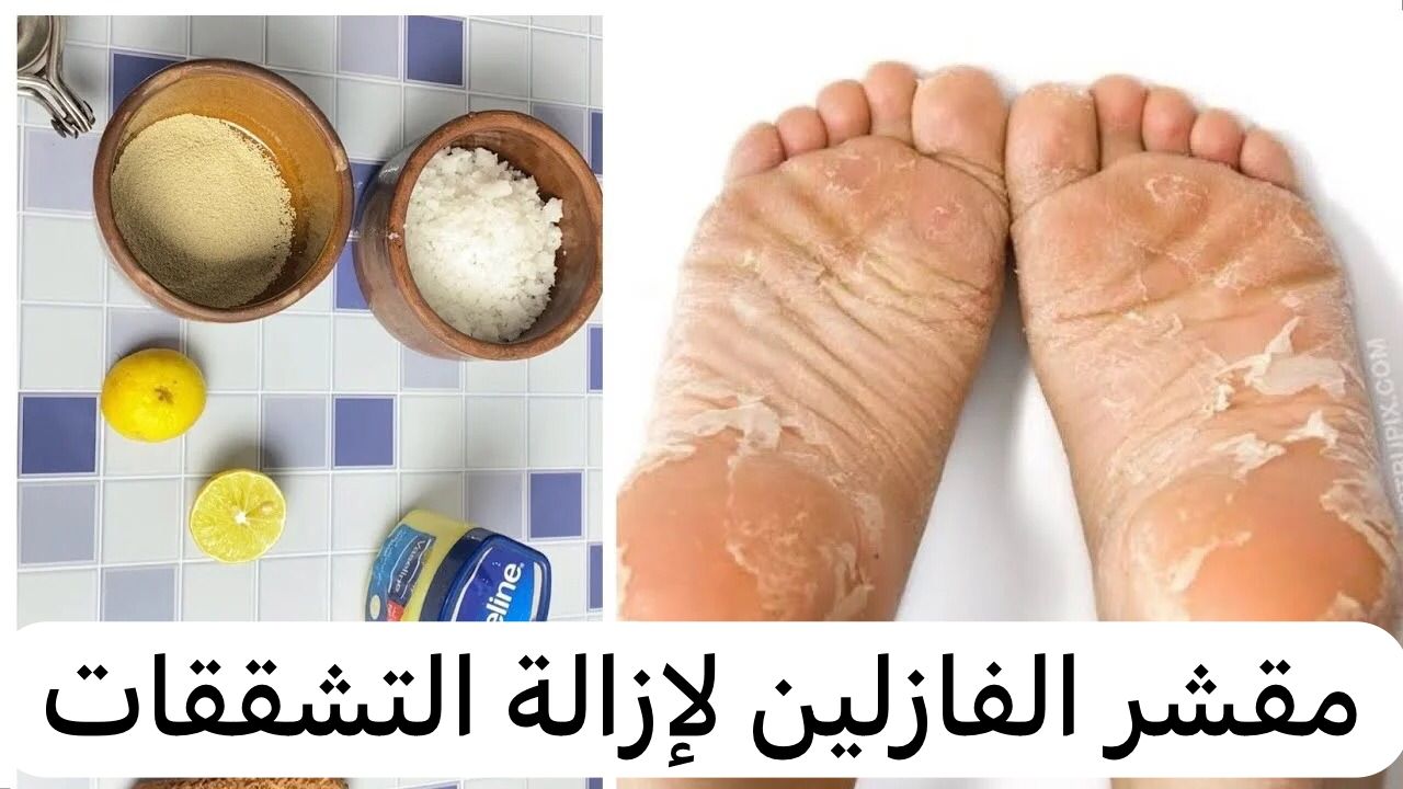 مقشر الفازلين لإزالة التشققات 